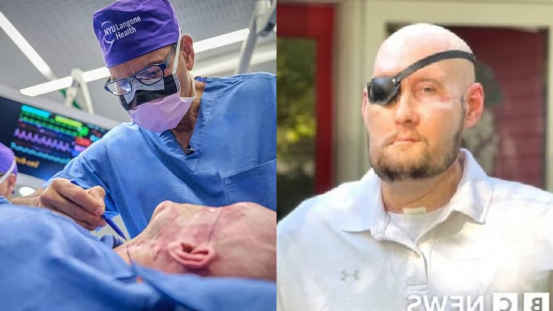 First of its Kind, as US Surgeons Perform World's First Whole Eye